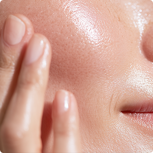 Oiliness & Congestion